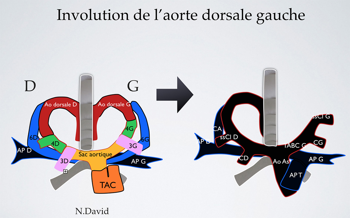 La coupe des 3 vaisseaux et de la trachée dans l’exploration du cœur