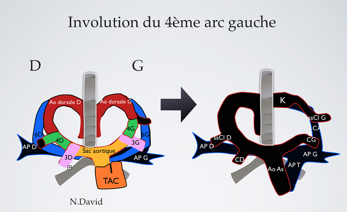 La coupe des 3 vaisseaux et de la trachée dans l’exploration du cœur