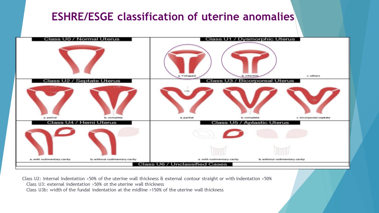 Les malformations utérines