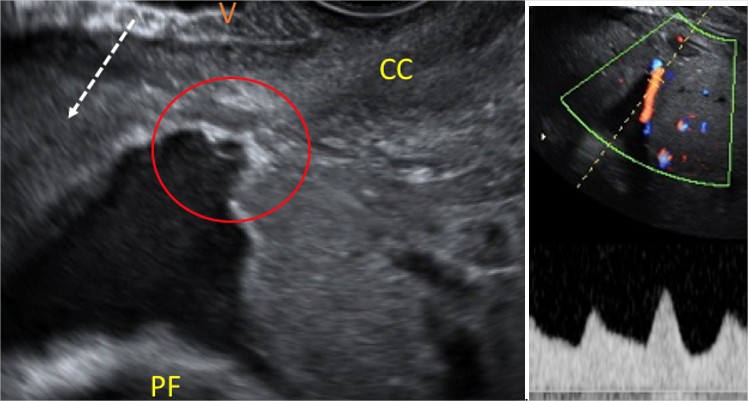 Figure4