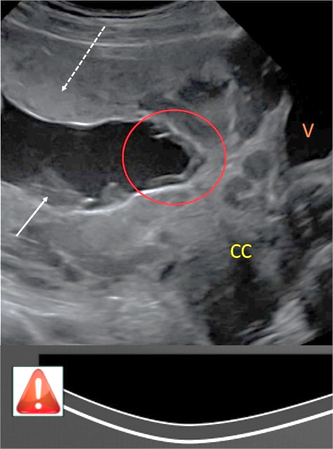 FIGURE2