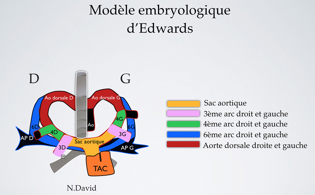 La coupe des 3 vaisseaux et de la trachée dans l’exploration du cœur