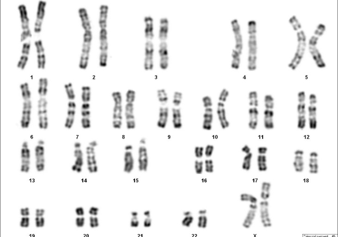 Cas N°1