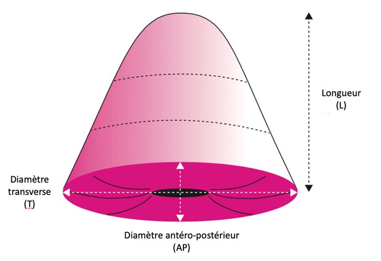 Modalités de mesures des dimensions de la pièce opératoire d’ERAD