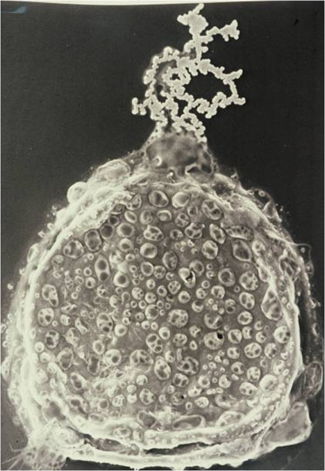 Blastocyste éclos montrant l’hétérogénéité cellulaire